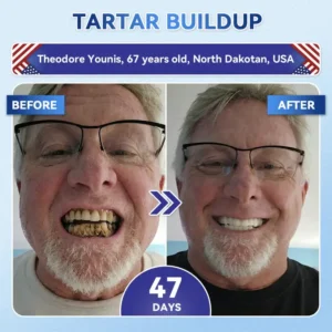 𝟓-𝒊𝒏-𝟏 𝑻𝒊𝒅𝒆𝒈𝒍𝒖𝒔𝒊𝒃 𝑻𝒐𝒐𝒕𝒉 𝑶𝒓𝒂𝒍 𝑺𝒕𝒓𝒊𝒑𝒔 & Gum Repair Oral Strips - Image 6