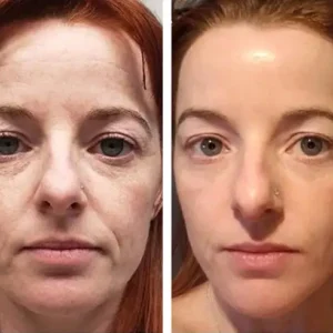 5-in-1 facial care - Image 7