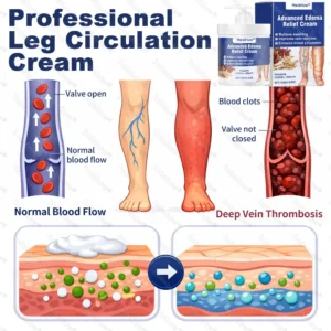 Advanced Edema Relief Cream - Image 3