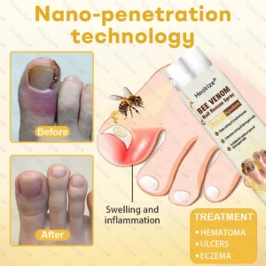 Bee Venom Nail Rescue Spray - Image 6