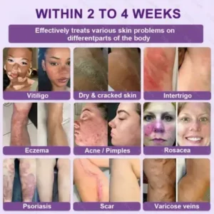 Biotin 10-in-1 Skin Restoration Cream - Image 3