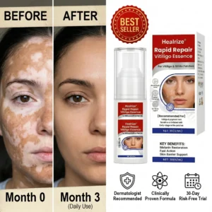 Rapid Repair Vitiligo Essence - Image 8