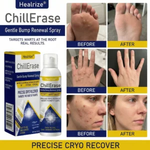 ❄️𝙎𝙥𝙚𝙘𝙞𝙖𝙡 𝙋𝙧𝙤𝙢𝙤𝙩𝙞𝙤𝙣 | ChillErase Gentle Bump Renewal Spray - Image 3