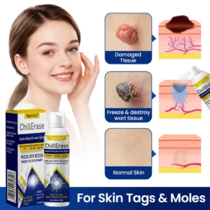 ChillErase Gentle Bump Renewal Spray—Stubborn Skin Bumps & Rough Spots - Image 2