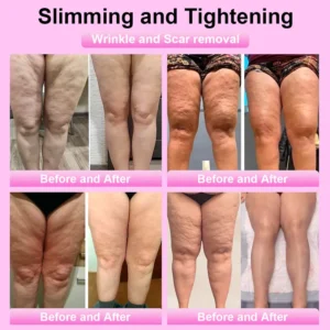 Advanced Fat-Burning & Firming Cream - Image 4