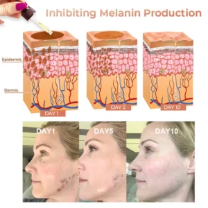 Niacinamide Brightening Serum - Image 5