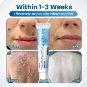 Fragile Skin Repair Cream - Image 3