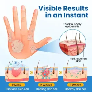 Fragile Skin Repair Cream - Image 6