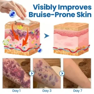 Fragile Skin Repair Cream - Image 7