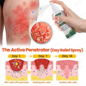Psoriasis Day & Night Repair System - Image 2