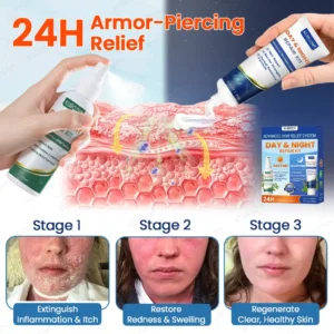 Psoriasis Day & Night Repair System - Image 6