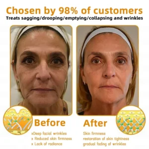 Bee Poison Skin Restoration Cream - Image 2