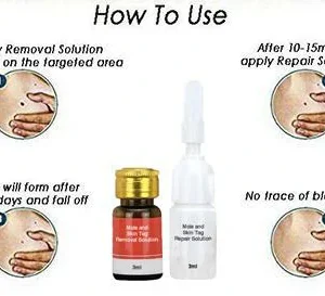 Mole & Skin Tag Removal Solution - Image 4