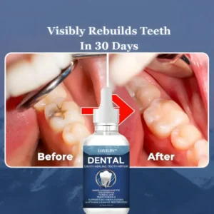 Advanced Enamel Repair & Whitening Kit - Image 5