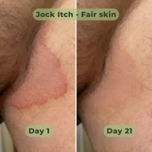 Antifungal Purifying Soap - Image 2
