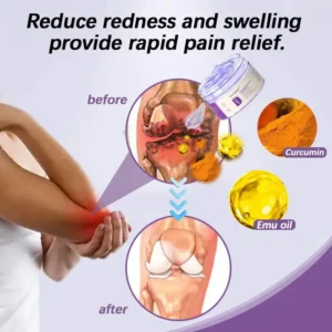 Arthritis Pain Relief Gel - Turmeric & Emu Oil Formula for Joint & Muscle Soothing - Image 8
