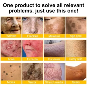 Bee Poison Skin Restoration Cream - Image 4