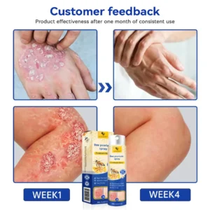 PsoriaHeal Bee Psoriasis Treatment Spray pro - Image 2