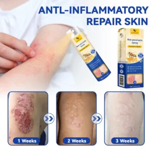 PsoriaHeal Bee Psoriasis Treatment Spray pro - Image 3