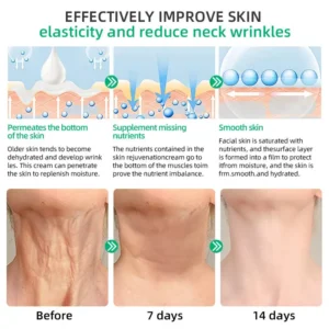 Wrinkle Removel Cream,Address Crepe & Sagging - Image 10
