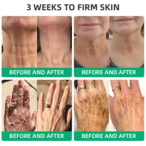 Wrinkle Removel Cream,Address Crepe & Sagging - Image 6