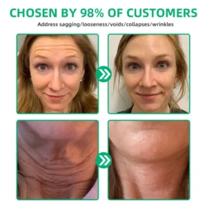 Wrinkle Removel Cream,Address Crepe & Sagging - Image 8