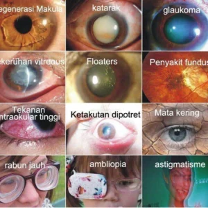 Japan Vision Drops — Rapidly Heals All Eye Conditions & Restores Vision - Image 4