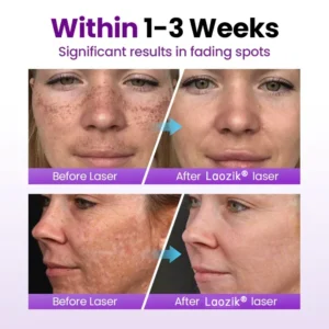 StainFade Facial Serum with Probiotics - Image 4