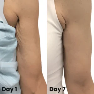 Collagen Oil – Firms Sagging Skin & Reduces Wrinkles Fast - Image 8