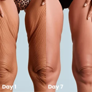 Collagen Oil – Firms Sagging Skin & Reduces Wrinkles Fast - Image 9