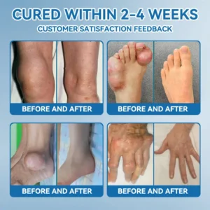 BPC-157 Joint Healing Cream - Image 5