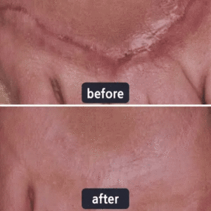 Scar Repair Cream - Image 10