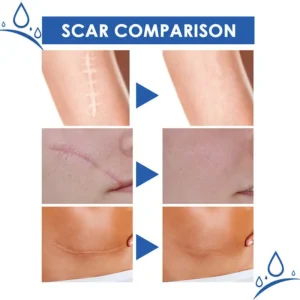 Scar Repair Cream - Image 7