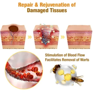 Australian Bee Venom Tags Removal Cream - Image 4