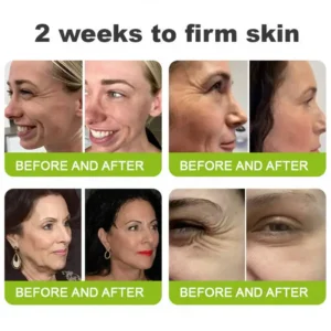 Botin & Vita-A Retinol Shot Wrinkle-Lift Tightening Cream - Image 6