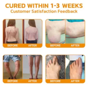 Pain-Relief Bone Healing Ointment - Image 4