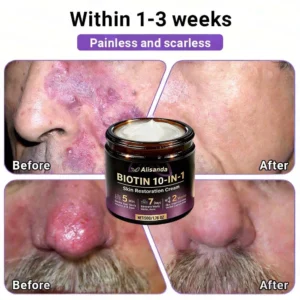 Biotin 10-in-1 Skin Restoration Cream - Image 6
