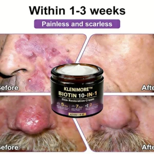 Biotin 10-in-1 Skin Restoration Cream - Image 13