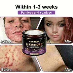 Biotin 10-in-1 Skin Restoration Cream - Image 8