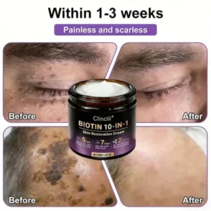 Biotin 10-in-1 Skin Restoration Cream – Last Day Promotion: 75% OFF - Image 7
