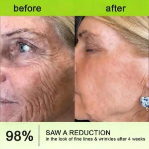 👨‍⚕️Made and shipped from the USA moringa & Vita-A Retinol Shot Wrinkle-Lift Tightening cream - Image 12