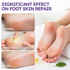 Tea Tree Oil Foot Cream - Image 6