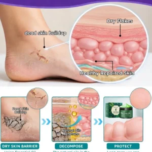 Tea Tree Oil Foot Cream - Image 9