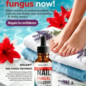 Nail Fungus – Advanced Antifungal Nail Drops (30 ml) - Image 2