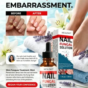 Nail Fungus – Advanced Antifungal Nail Drops (30 ml) - Image 3