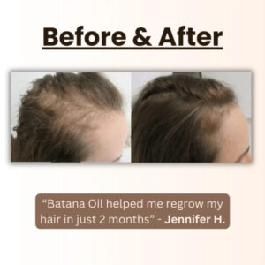 Natural Herbal Handcrafted Batana Oil Hair Growth Blend 4.2OZ - Image 3