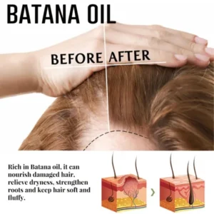 Natural Herbal Handcrafted Batana Oil Hair Growth Blend 4.2OZ - Image 6