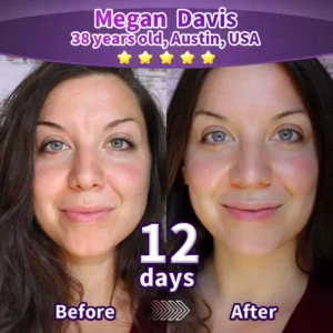 2-in-1 Bakuchiol Peptide Lifting Mask + Firming Body Serum - Image 5