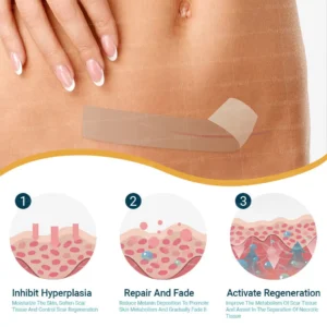 Hyaluronic Acid Microneedle Repair Tape - Image 4