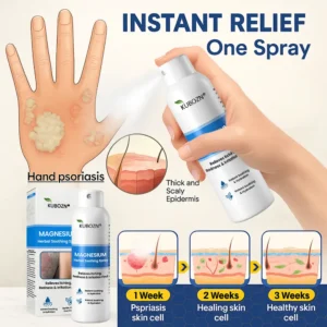 Magnesium Herbal Psoriasis Spray - Image 3